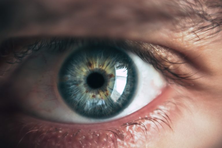 OPERASI LASIK, ALTERNATIF SOLUSI UNTUK MATA LEBIH SEHAT